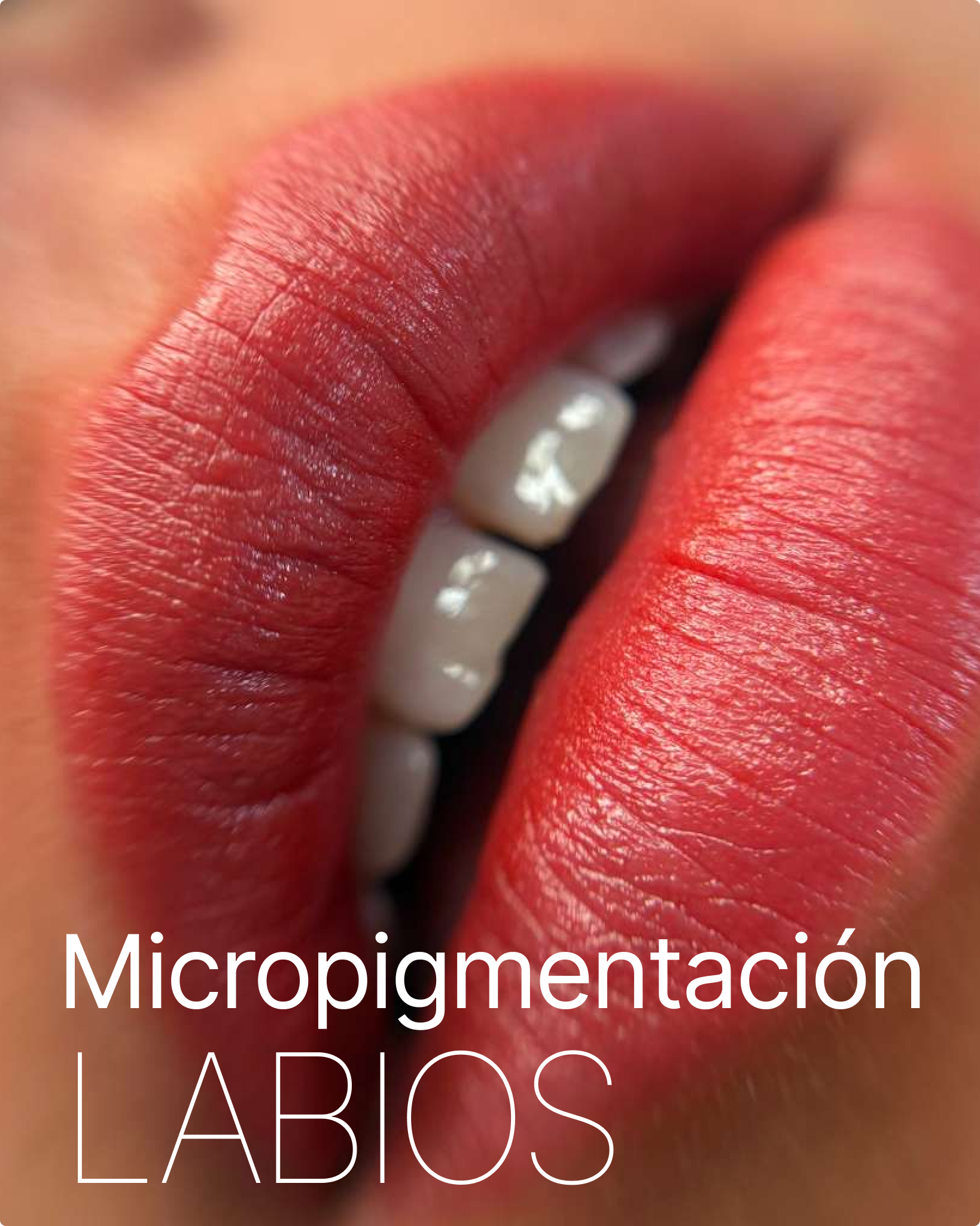 labios